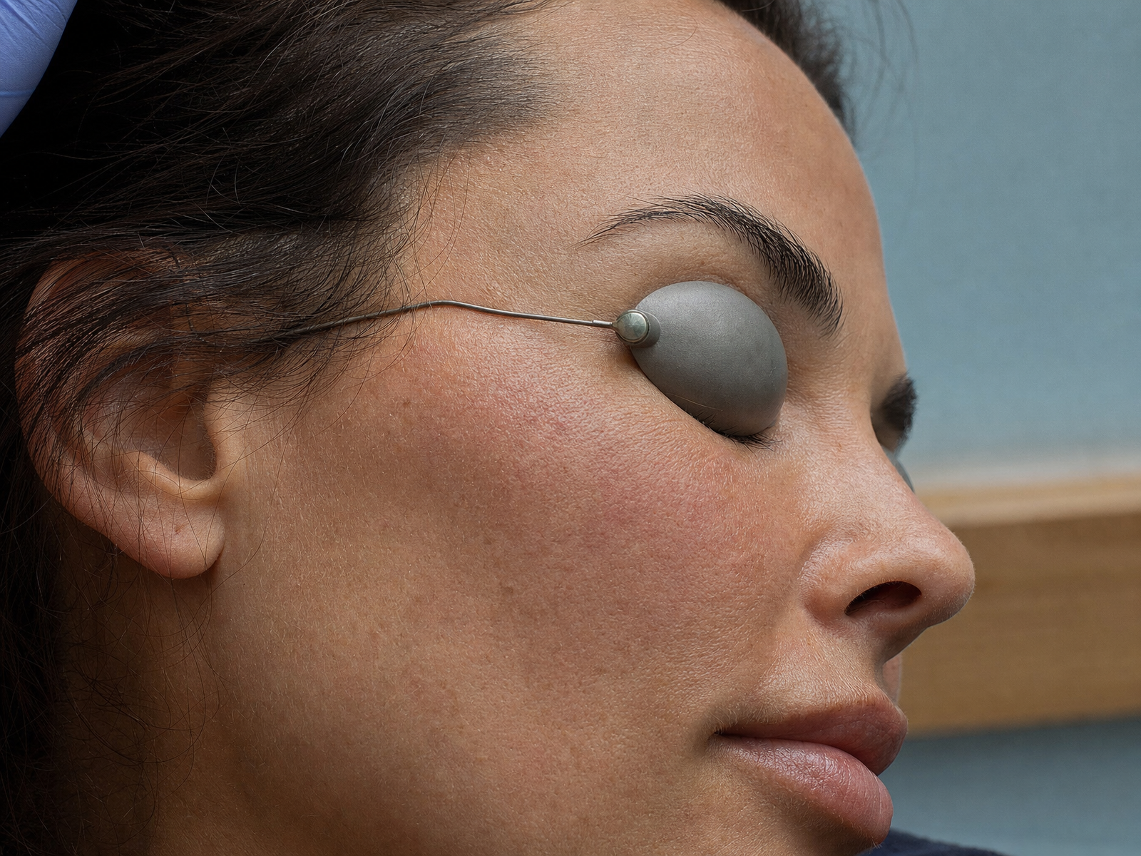 Laser treatment